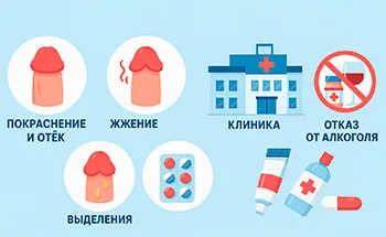 Баланопостит и баланит у мужчин: как эффективно лечить